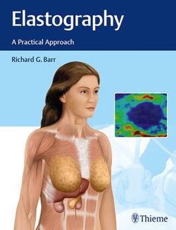Elastography A Practical Approach  9781626232716 Front Cover