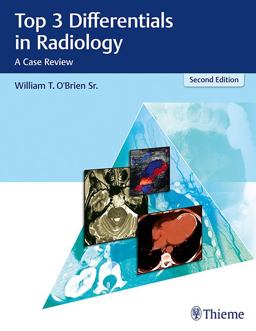 Top 3 Differentials in Radiology A Case Review 2nd 9781626232785 Front Cover