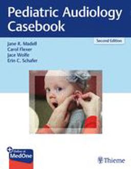 Pediatric Audiology Casebook 2nd 9781626234031 Front Cover