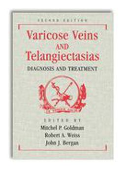 Varicose Veins and Telangiectasias: Diagnosis and Treatment, Second Edition 2nd 9781626235489 Front Cover