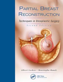 Partial Breast Reconstruction Techniques in Oncoplastic Surgery 2nd 9781626236912 Front Cover