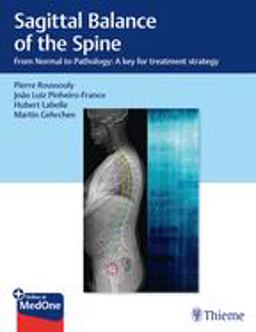 Sagittal Balance of the Spine From Normal to Pathology: a Key for Treatment Strategy  9781626237322 Front Cover