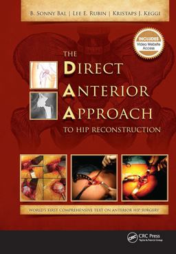 Direct Anterior Approach to Hip Reconstruction  9781630910273 Front Cover