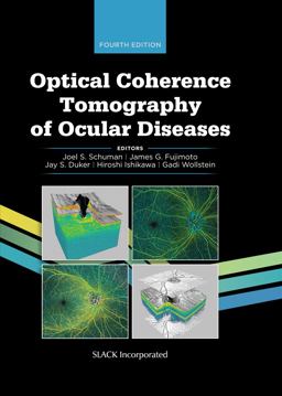 Optical Coherence Tomography of Ocular Diseases 4th 9781630917081 Front Cover