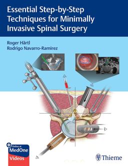 Essential Step-By-Step Techniques for Minimally Invasive Spinal Surgery  9781684200092 Front Cover