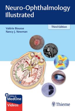 Neuro-Ophthalmology Illustrated 3rd 9781684200740 Front Cover