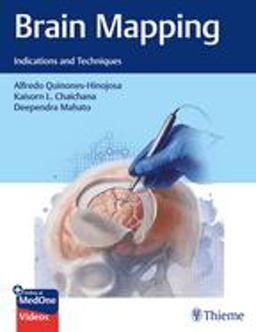 Brain Mapping Indications and Techniques  9781684200924 Front Cover