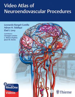 Video Atlas of Neuroendovascular Procedures  9781684201181 Front Cover