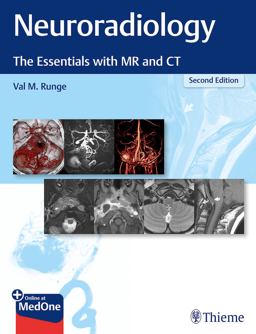 Neuroradiology: The Essentials With Mr and Ct  9781684201532 Front Cover