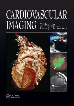 Cardiovascular Imaging  9781840761092 Front Cover