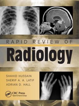 Rapid Review of Radiology  9781840761207 Front Cover