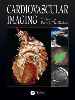 Cardiovascular Imaging  9781840761917 Front Cover