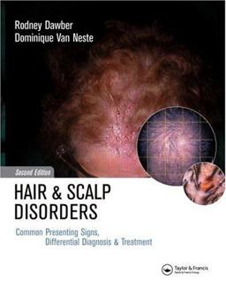 Hair and Scalp Disorders Common Presenting Signs, Differential Diagnosis and Treatment 2nd 9781841841939 Front Cover