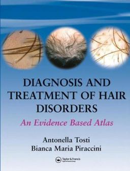 Diagnosis and Treatment of Hair Disorders An Evidence Based Atlas  9781841843407 Front Cover