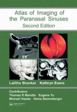 Atlas of Imaging of the Paranasal Sinuses, Second Edition 2nd 9781841844480 Front Cover