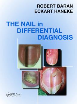 Nail in Differential Diagnosis  9781841845067 Front Cover
