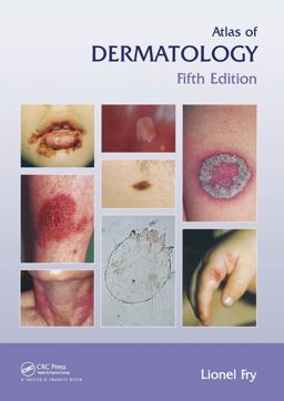 Atlas of Dermatology, Fifth Edition 5th 9781841845227 Front Cover