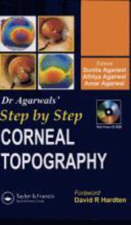 Step by Step Corneal Topography Step by Step Corneal Topography
