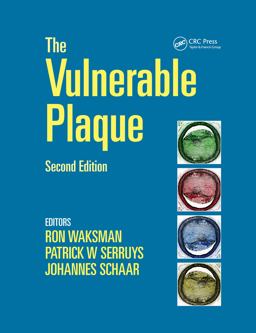 Handbook of the Vulnerable Plaque