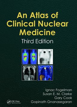 Atlas of Clinical Nuclear Medicine 3rd 9781841846538 Front Cover
