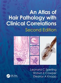 Atlas of Hair Pathology with Clinical Correlations 2nd 9781841847337 Front Cover