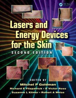 Lasers and Energy Devices for the Skin 2nd 9781841849331 Front Cover