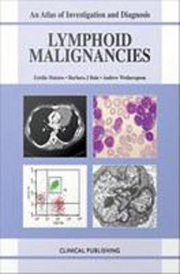 Lymphoid Malignancies Lymphoid Malignancies