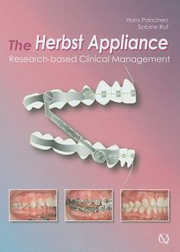 Herbst Appliance: Research-based Clinical Management  9781850971696 Front Cover
