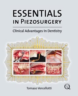 Essentials in Piezosurgery Clinical Advances in Dentistry  9781850971900 Front Cover