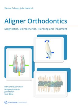 Aligner Orthodontics: Diagnostics, Biomechanics, Planning and Treatment  9781850972846 Front Cover