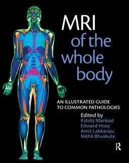 MRI of the Whole Body An Illustrated Guide for Common Pathologies  9781853157769 Front Cover