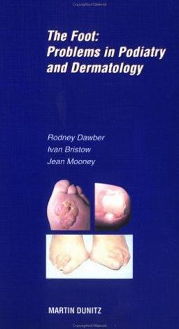 Nail and Skin Infections of the Foot