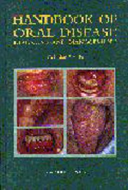 Diagnostic Handbook of Oral Disease