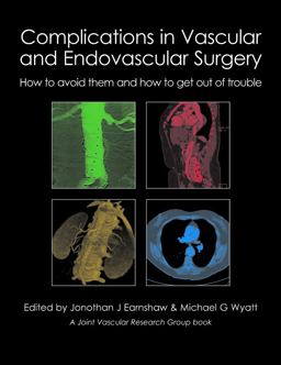 Complications in Vascular and Endovascular Surgery How to Avoid Them and How to Get Out of Trouble  9781903378809 Front Cover