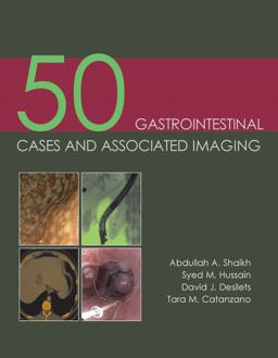 50 Gastrointestinal Cases and Associated Imaging  9781903378854 Front Cover