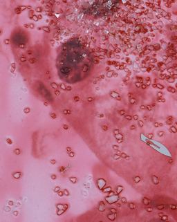 Damien Hirst: Beyond Belief Damien Hirst: Beyond Belief