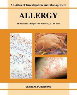 Allergy