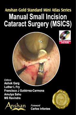 Manual Small Incisions in Cateract Surgery (MSICS)  9781905740468 Front Cover