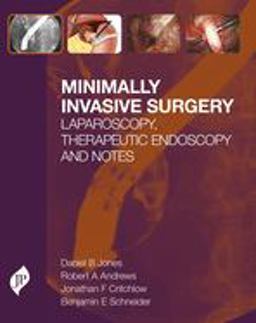 Minimally Invasive Surgery