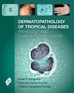 Dermatopathology of Tropical Diseases Pathology and Clinical Correlations  9781909836068 Front Cover