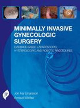 Minimally Invasive Gynecologic Surgery Evidence-Based Laparoscopic, Hysteroscopic and Robotic Surgeries  9781909836099 Front Cover