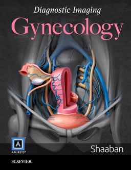 Diagnostic Imaging: Gynecology 2nd 9781931884778 Front Cover