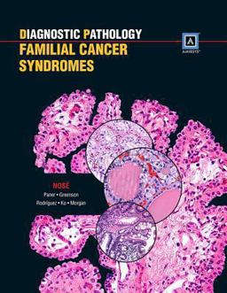 Familial Cancer Syndromes Familial Cancer Syndromes