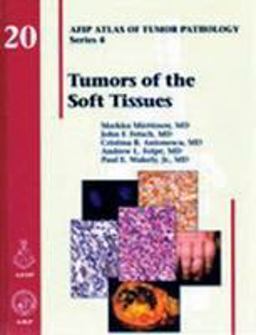 Tumors of the Soft Tissues  9781933477312 Front Cover