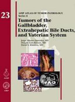Tumors of the Gallbladder, Extrahepatic Bile Ducts, and Vaterian System  9781933477343 Front Cover