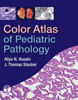 Color Atlas of Pediatric Pathology  9781933864570 Front Cover