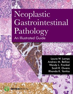 Neoplastic Gastrointestinal Pathology