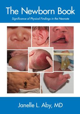 Newborn Book Significance of the Physical Findings in the Neonate  9781938512278 Front Cover