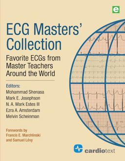 ECG Masters' Collection ECG Masters' Collection