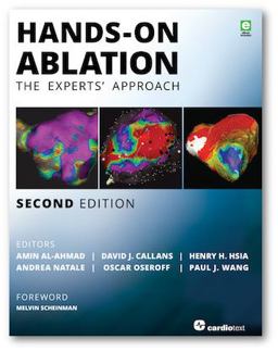 Hands-On Ablation Hands-On Ablation